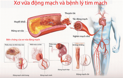 Một số chứng bệnh tim nguy hiểm thường gặp - Ảnh 1.