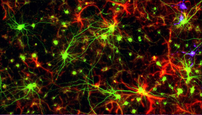 Các nhà khoa học kinh ngạc khi phát hiện sự tương đồng kỳ lạ giữa não người và vũ trụ - Ảnh 1.