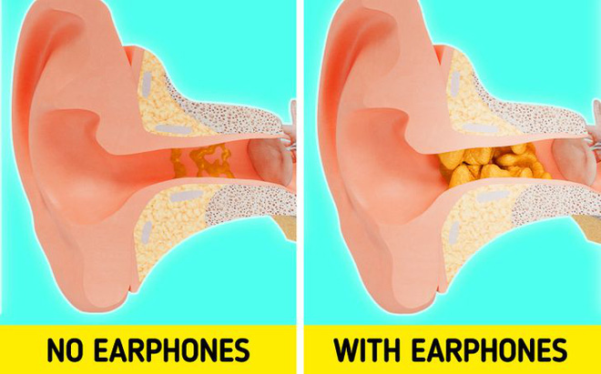 Cảnh báo: Nếu tiếp tục đeo tai nghe lâu, đây sẽ là điều xảy ra với cơ thể bạn - Ảnh 4.