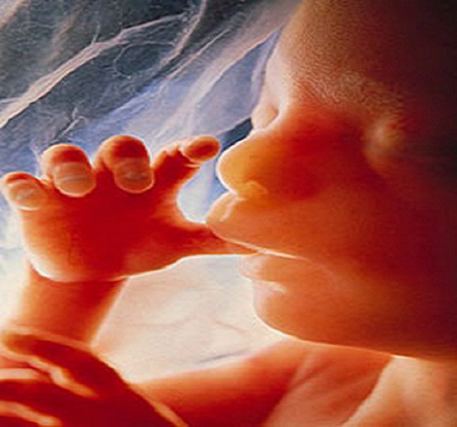 15 năm sau khi phá thai, bà mẹ choáng váng khi phát hiện con vẫn còn trong bụng và hiện tượng bào thai hóa đá hiếm gặp - Ảnh 5.