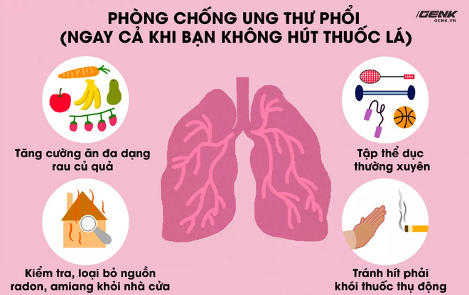 Tại sao không hút thuốc lá vẫn mắc ung thư phổi? Hóa ra đó là một dạng ung thư khác - Ảnh 3.