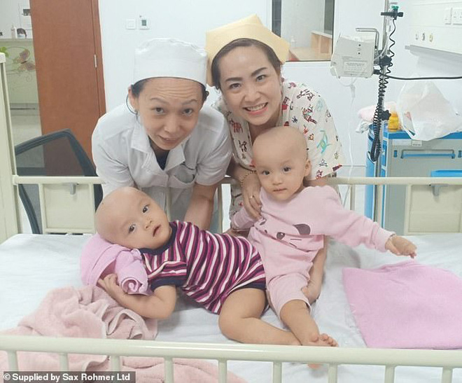 Ca phẫu thuật tách rời thành công cặp song sinh Trúc Nhi - Diệu Nhi của các y bác sĩ Việt Nam thu hút sự chú ý báo chí nước ngoài - Ảnh 2.