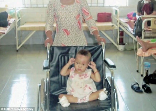 Sau 17 năm được nhận nuôi ở Mỹ, cuộc sống hiện tại của bé gái Việt mất 2 chân sau vụ nổ thương tâm khiến ai cũng phải ngạc nhiên - Ảnh 3.