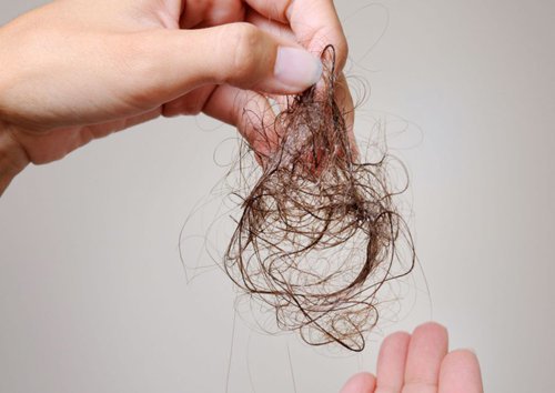 3 thủ phạm rụng tóc: người bị phải nhớ nguyên nhân còn điều trị - Ảnh 1.
