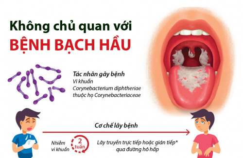 Bạch hầu ác tính khiến 3 trẻ ở Tây Nguyên tử vong nguy hiểm thế nào? - Ảnh 4.