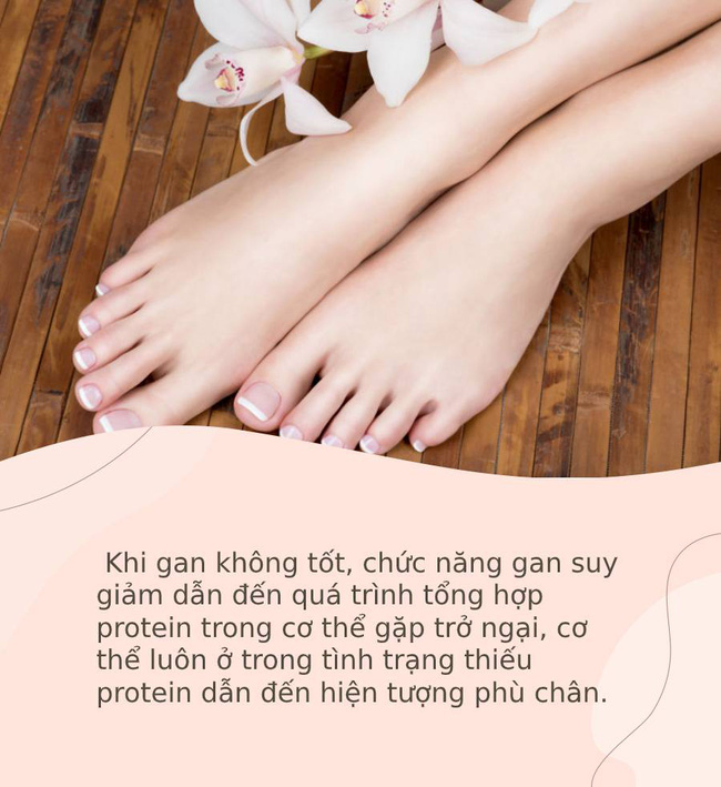 Bàn chân giống như đồng hồ sức khoẻ, 3 dấu hiệu này trên bàn chân cho biết rất có thể gan của bạn đang gặp vấn đề - Ảnh 3.