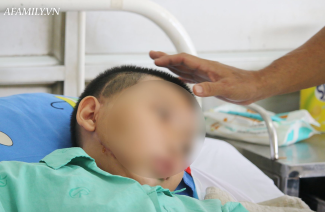Bé trai 13 tuổi mang khối u xơ vòm họng khổng lồ lần đầu tiên ghi nhận tại Việt Nam - Ảnh 3.