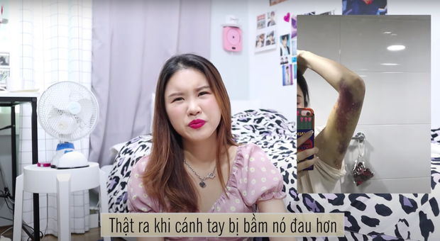 Nghe loạt YouTuber review chân thực từ chuyện sửa mũi, hút mỡ đến đập mặt đi xây lại hết nửa tỉ đồng - Ảnh 1.