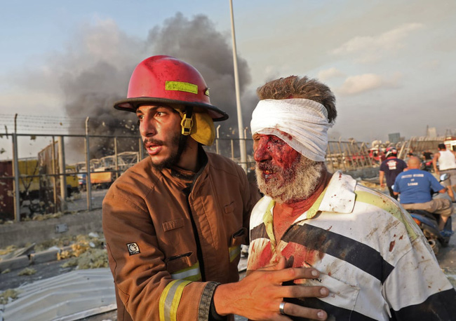 Những hình ảnh thương tâm tại hiện trường vụ nổ kinh hoàng đang làm chấn động thủ đô của Liban - Ảnh 11.