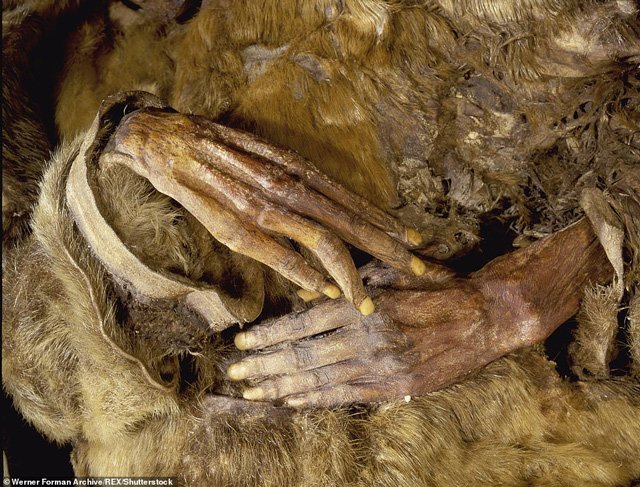 Lắng nghe xác ướp đôi bạn Eskimo 1.500 tuổi kể chuyện bị xơ vữa động mạch trước khi chết - Ảnh 1.