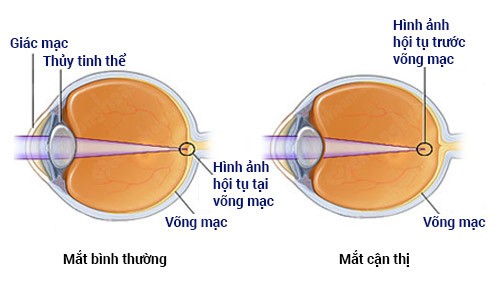 Ngồi nhìn màn hình quá lâu có hại cho mắt không? Đây là câu trả lời cho anh em - Ảnh 2.