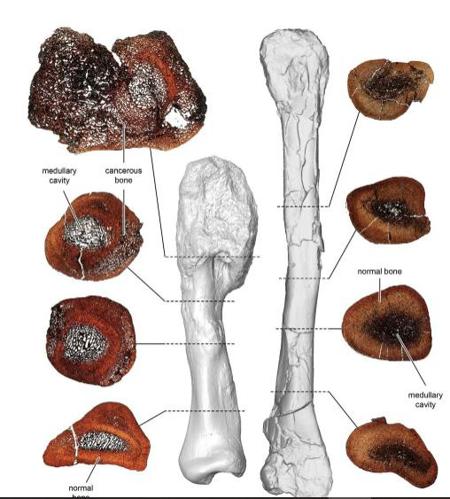 Tìm thấy khối u ác tính 76 triệu năm trong xương khủng long - Ảnh 1.