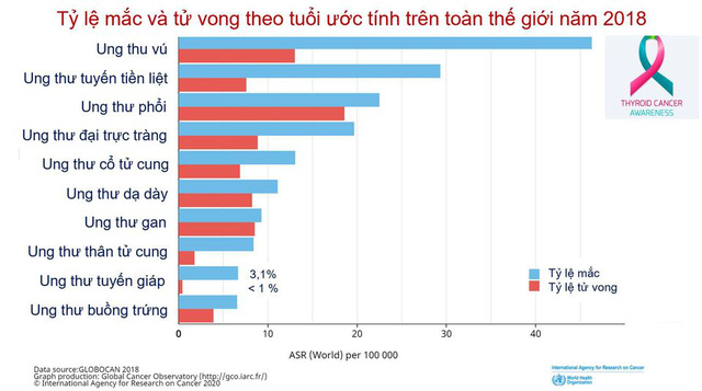 Ung thư tuyến giáp chiếm 90% bệnh nhân ung thư nội tiết, dấu hiệu âm thầm nhưng có thể điều trị được: Bác sĩ BV Bạch Mai chỉ rõ 5 điều quan trọng về căn bệnh này - Ảnh 1.