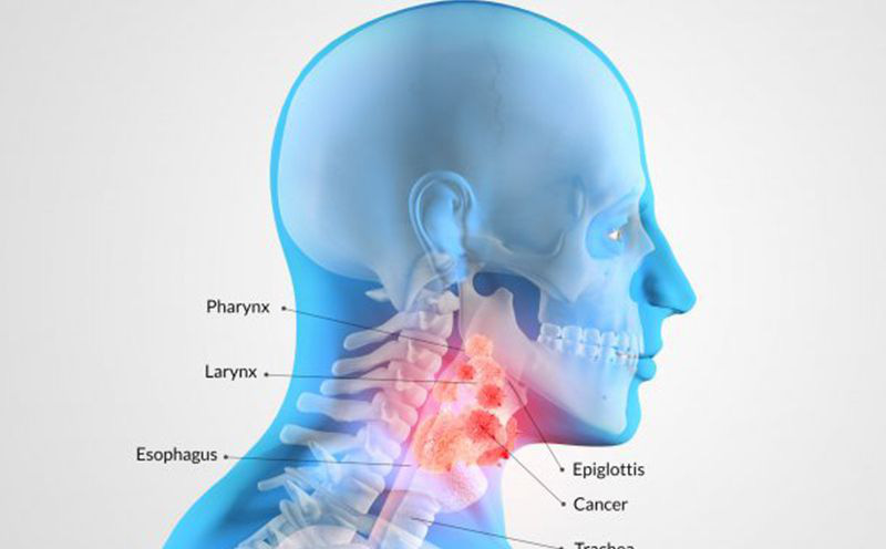 Nghệ sĩ Giang còi mắc ung thư giai đoạn muộn: Người Việt ...