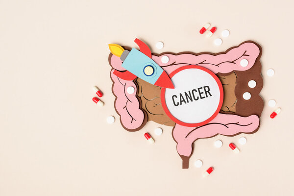 Chuyên gia cảnh báo: Ăn nhiều chất này sẽ nuôi lớn tế bào ung thư, làm chết đói các tế bào miễn dịch - Ảnh 1.