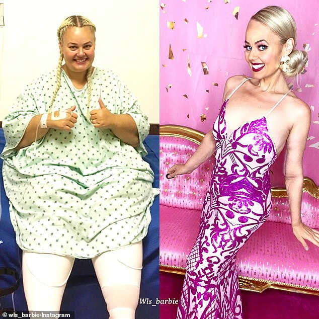 Nàng béo 154 kg phẫu thuật cắt bỏ 80% dạ dày, lột xác kinh ngạc để giống búp bê Barbie - Ảnh 3.