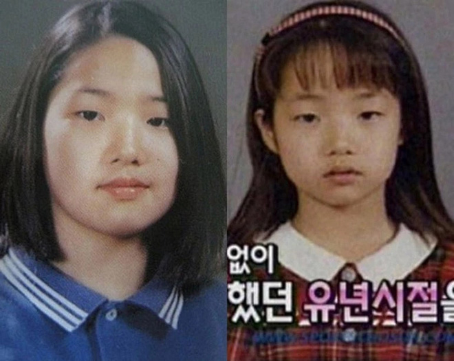 Muốn kiểm chứng thế nào là dao kéo thành công bậc nhất, nhất định phải xem màn lột xác như đổi đầu của dàn mỹ nhân Hàn này - Ảnh 2.