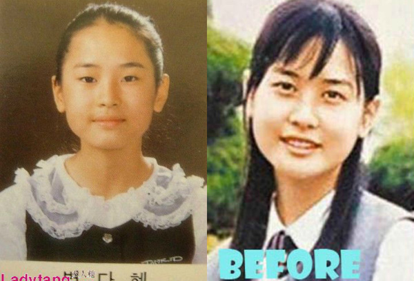 Muốn kiểm chứng thế nào là dao kéo thành công bậc nhất, nhất định phải xem màn lột xác như đổi đầu của dàn mỹ nhân Hàn này - Ảnh 11.