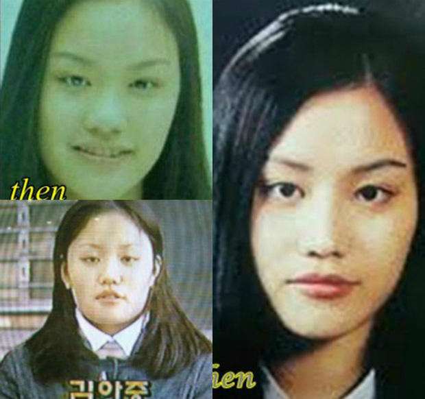 Muốn kiểm chứng thế nào là dao kéo thành công bậc nhất, nhất định phải xem màn lột xác như đổi đầu của dàn mỹ nhân Hàn này - Ảnh 31.