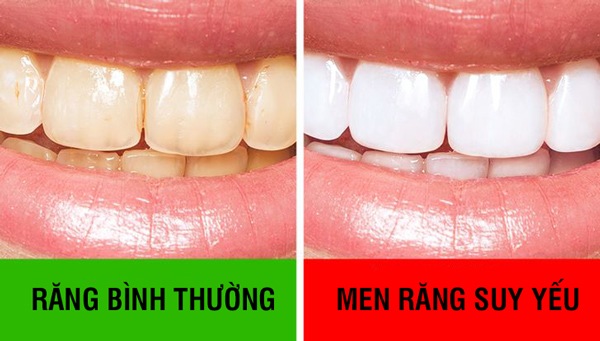 Đánh răng thôi chưa đủ, làm thêm 10 mẹo này giúp bạn có hàm răng chắc khỏe - Ảnh 3.