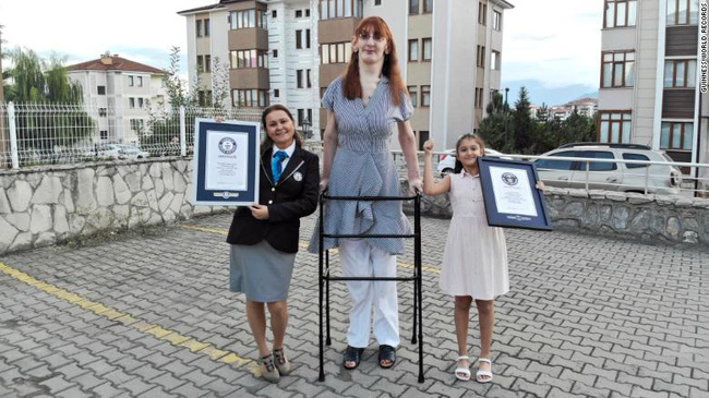 Kỷ lục Guinness xác nhận người phụ nữ cao nhất thế giới ở Thổ Nhĩ Kỳ - Ảnh 1.