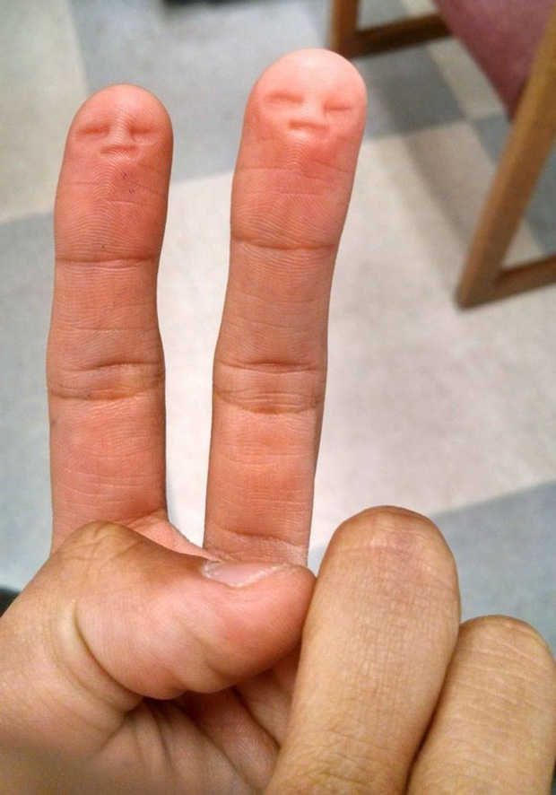 14 dị nhân có đặc điểm cơ thể siêu thú vị: Người 4 ngón, kẻ vặn ngược tay - Ảnh 13.