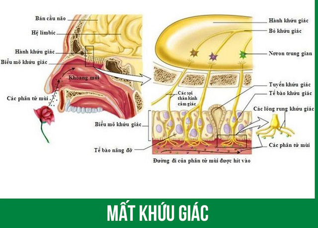 Chứng mất khứu giác, vị giác ở bệnh nhân COVID-19: Tự khỏi hay cần điều trị? - Ảnh 1.