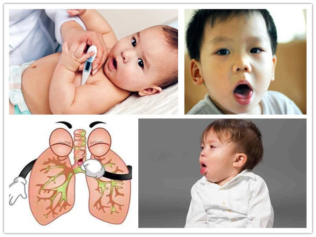 Cách phân biệt ho do viêm phổi và cảm lạnh - Ảnh 2.