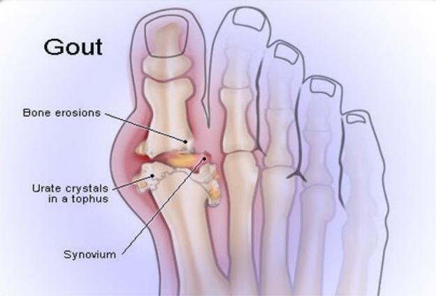 Uống quá nhiều rượu là tích luỹ ít nhất 10 căn bệnh nguy hiểm - Ảnh 9.