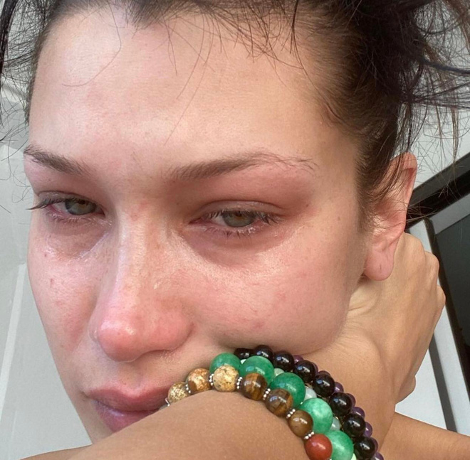 Bella Hadid's tears: When Instagram filters cannot hide mental crises - Photo 4.