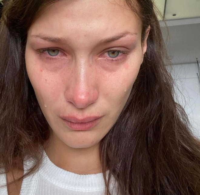 Bella Hadid's tears: When Instagram filters cannot hide mental crises - Photo 5.