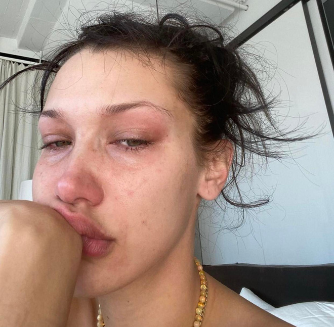 Bella Hadid's tears: When Instagram filters cannot hide mental crises - Photo 8.