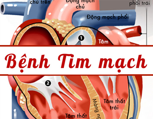 7 yếu tố nguy cơ gây bệnh tim mạch có thể phòng tránh được - Ảnh 1.