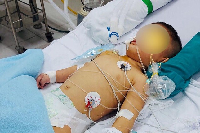 Bé trai 14 tháng tuổi tổn thương não vì gặp tai nạn thương tâm ngay tại nhà - Ảnh 1.