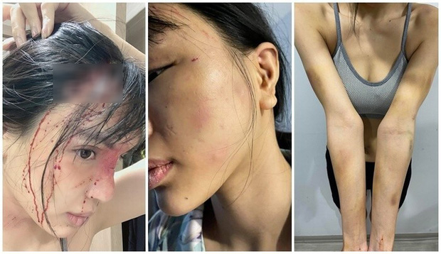 NÓNG: Siêu mẫu Khả Trang công bố quá trình được mẹ đẻ và công an giải cứu sau 2 ngày bị giam lỏng hành hung - Ảnh 3.