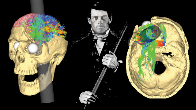  Phineas Gage và vụ tai nạn đã khai sinh ra khoa học thần kinh hiện đại  - Ảnh 1.