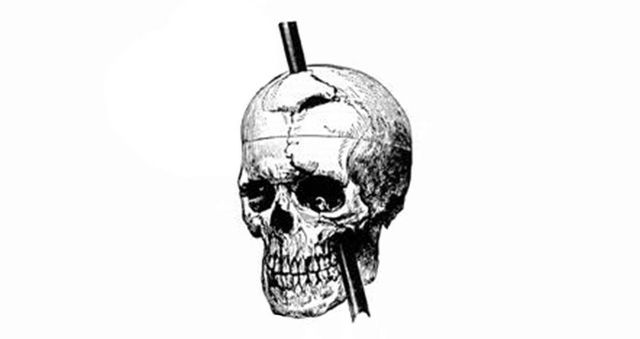  Phineas Gage và vụ tai nạn đã khai sinh ra khoa học thần kinh hiện đại  - Ảnh 2.