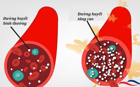 Thực phẩm giúp kiểm soát đường huyết tốt người bệnh đái tháo đường nên ăn mỗi ngày - Ảnh 1.