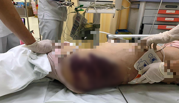 Bác bé gái 8 tuổi: Đau đớn khi đọc lời khai, đánh cháu 30 phút thì khác nào giết người - Ảnh 1.