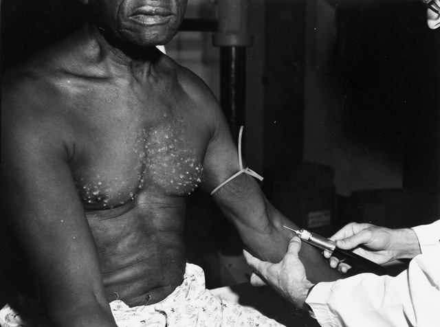  Thí nghiệm Tuskegee: một trong những dự án phi đạo đức nhất lịch sử  - Ảnh 6.