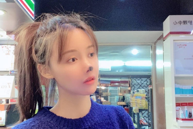 Nữ diễn viên Trung Quốc phẫu thuật thẩm mỹ tới nỗi rụng cả mũi, ngượng không dám thò mặt ra đường - Ảnh 3.