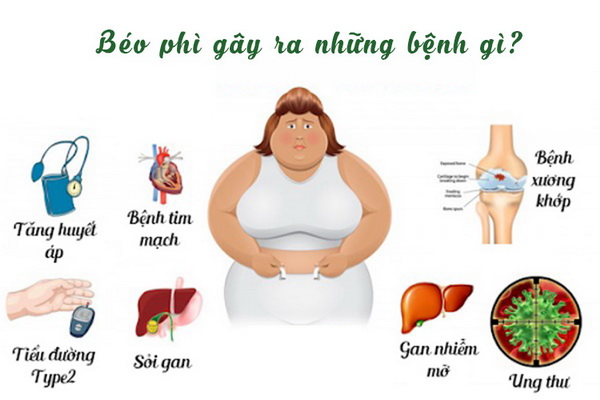 Những bệnh người béo phì dễ mắc - Ảnh 1.