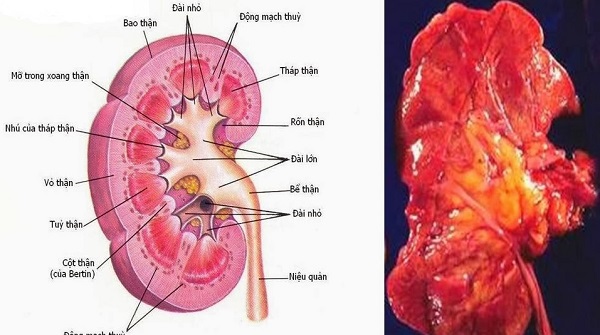 Bài thuốc hỗ trợ trị viêm cầu thận cấp - Ảnh 1.