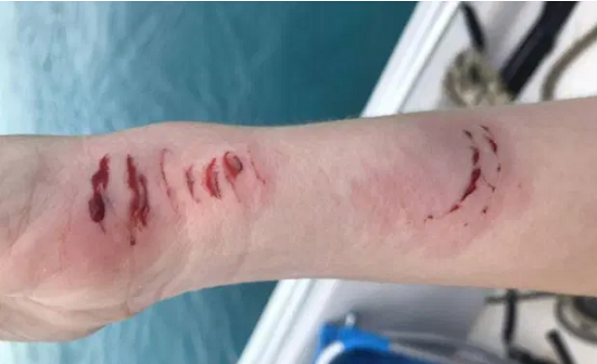 Nhởn nhơ chụp ảnh cùng cá mập trong tuần trăng mật, cô gái nhận kết cục đau đớn không ngờ - Ảnh 3.