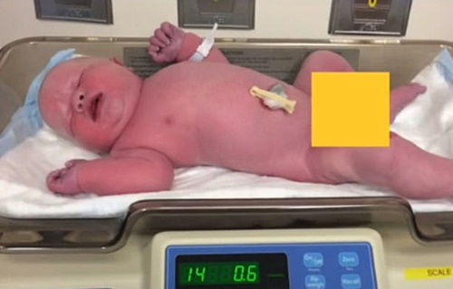 Bé trai chào đời nặng 6,4kg bằng con nhà người ta 2 tháng, ngoại hình lúc 5 tuổi gây ngỡ ngàng - Ảnh 1.