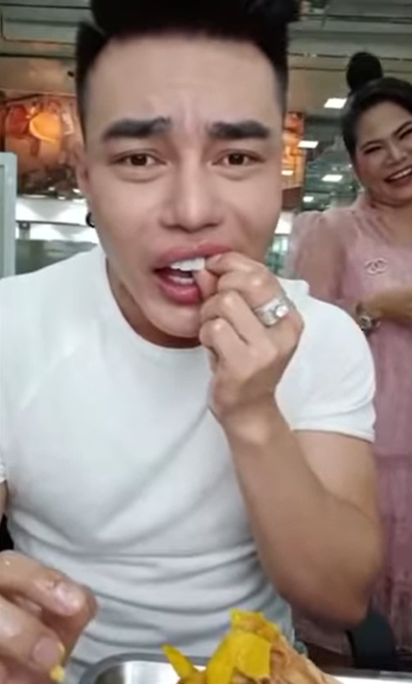 Lê Dương Bảo Lâm gặp sự cố khi livestream: Ăn gà bị mẻ răng sứ, phải mượn keo gắn - Ảnh 1.