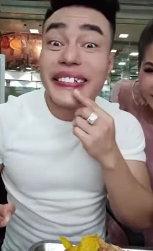 Lê Dương Bảo Lâm gặp sự cố khi livestream: Ăn gà bị mẻ răng sứ, phải mượn keo gắn - Ảnh 4.