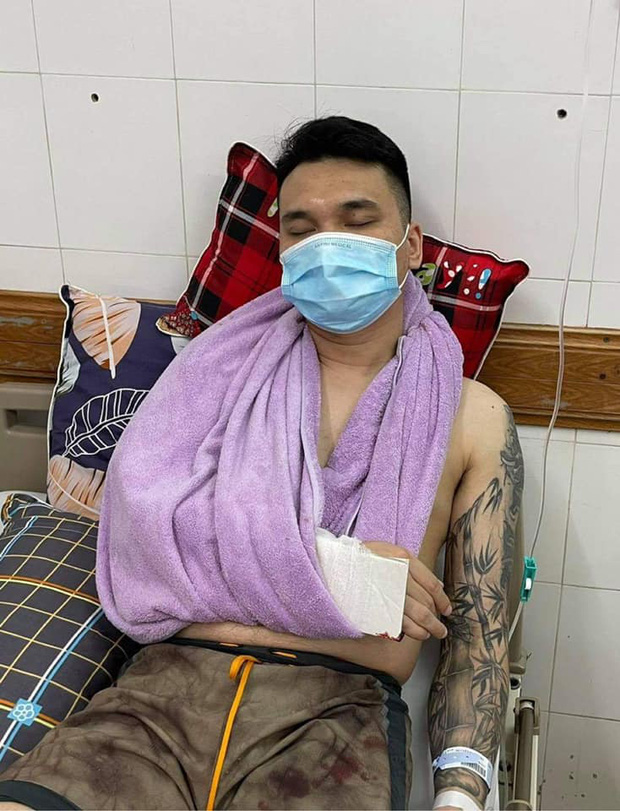 Khắc Việt nhập viện cấp cứu vì gãy tay, tạm thời cầm máu và bó nẹp chờ lên bàn mổ - Ảnh 1.