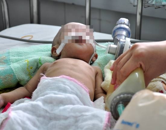 Mẹ dùng lá ổi để chữa tiêu chảy cho con 19 tháng tuổi và cái kết - Ảnh 1. Mẹ dùng lá ổi để chữa tiêu chảy cho con 19 tháng tuổi và cái kết - Ảnh 1.