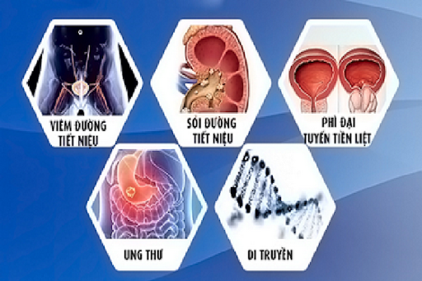 Điểm mặt “thủ phạm” gây tiểu máu - Ảnh 1.